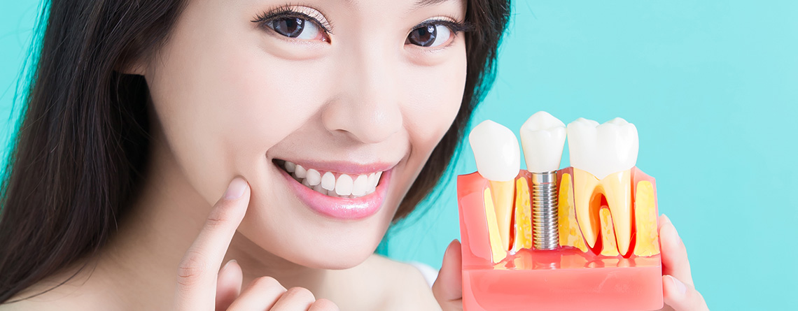 Dental Implants UAE